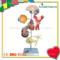 Medical Plastic Hypertension Teaching Model